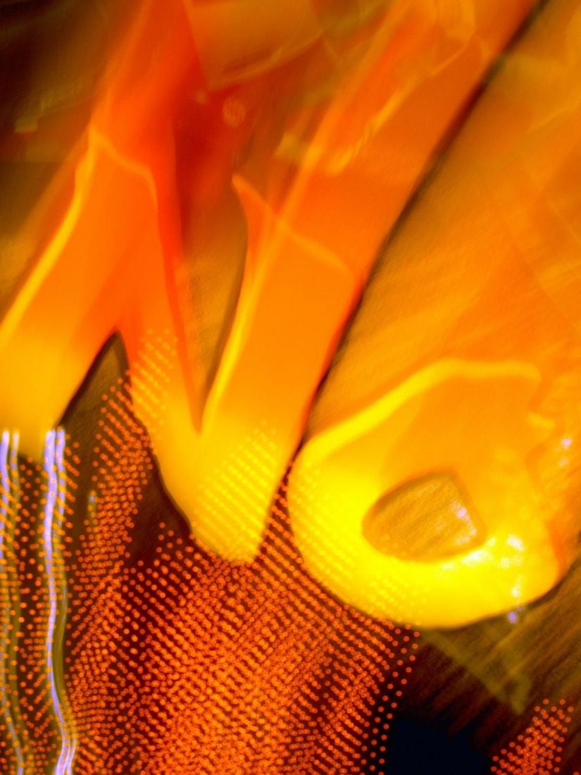 Volt egyszer egy szeparáció 