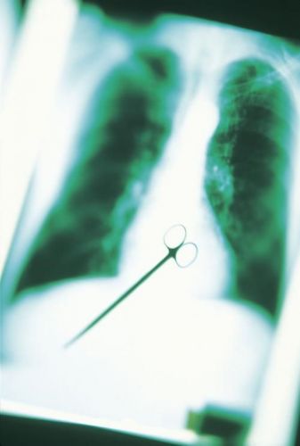 Tévedni emberi dolog  