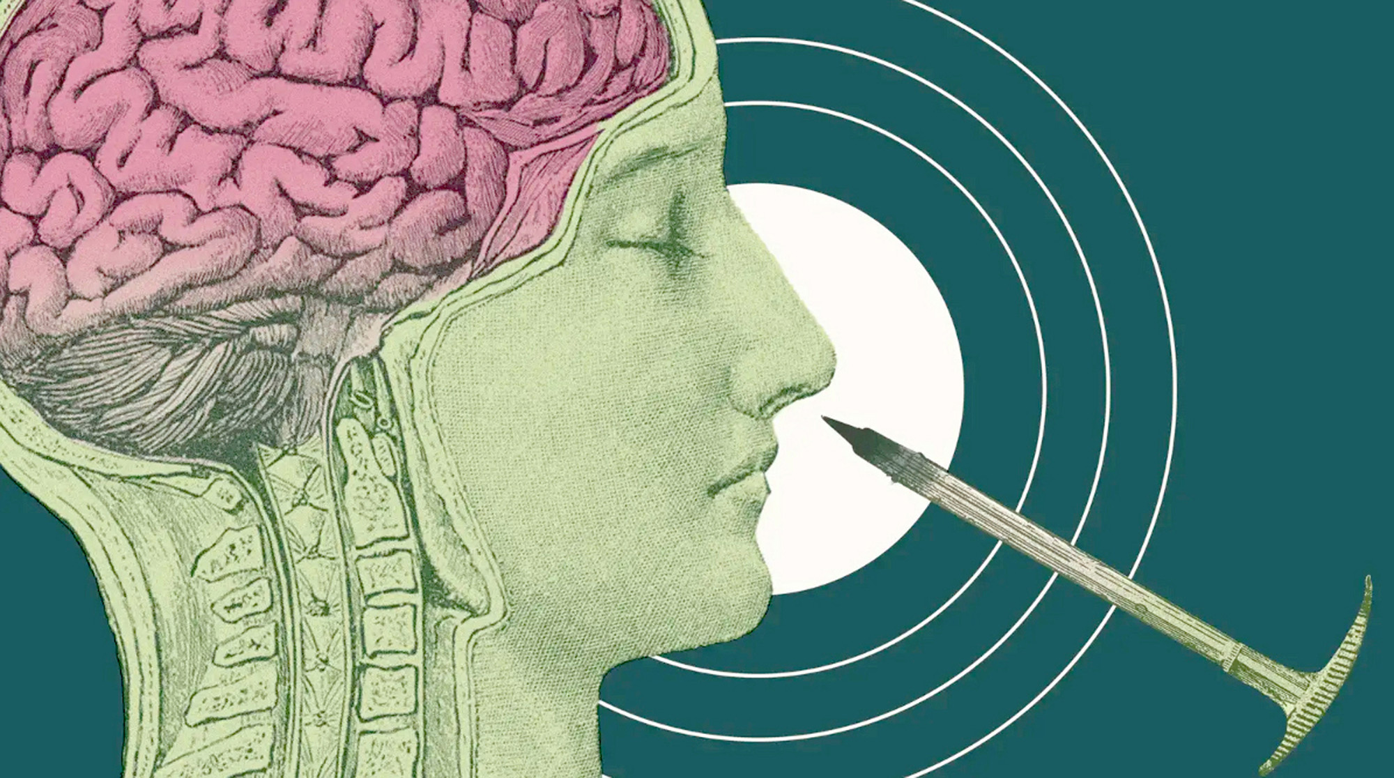 A lobotómia hátborzongató története