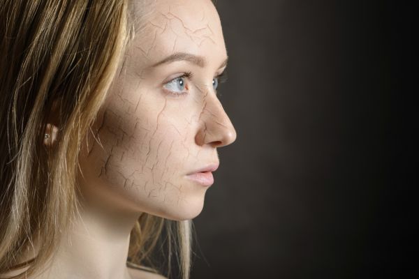 Érzékeny a b?röm, érzékeny a lelkem is?